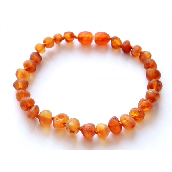 Baroque-Amber-Bracelet